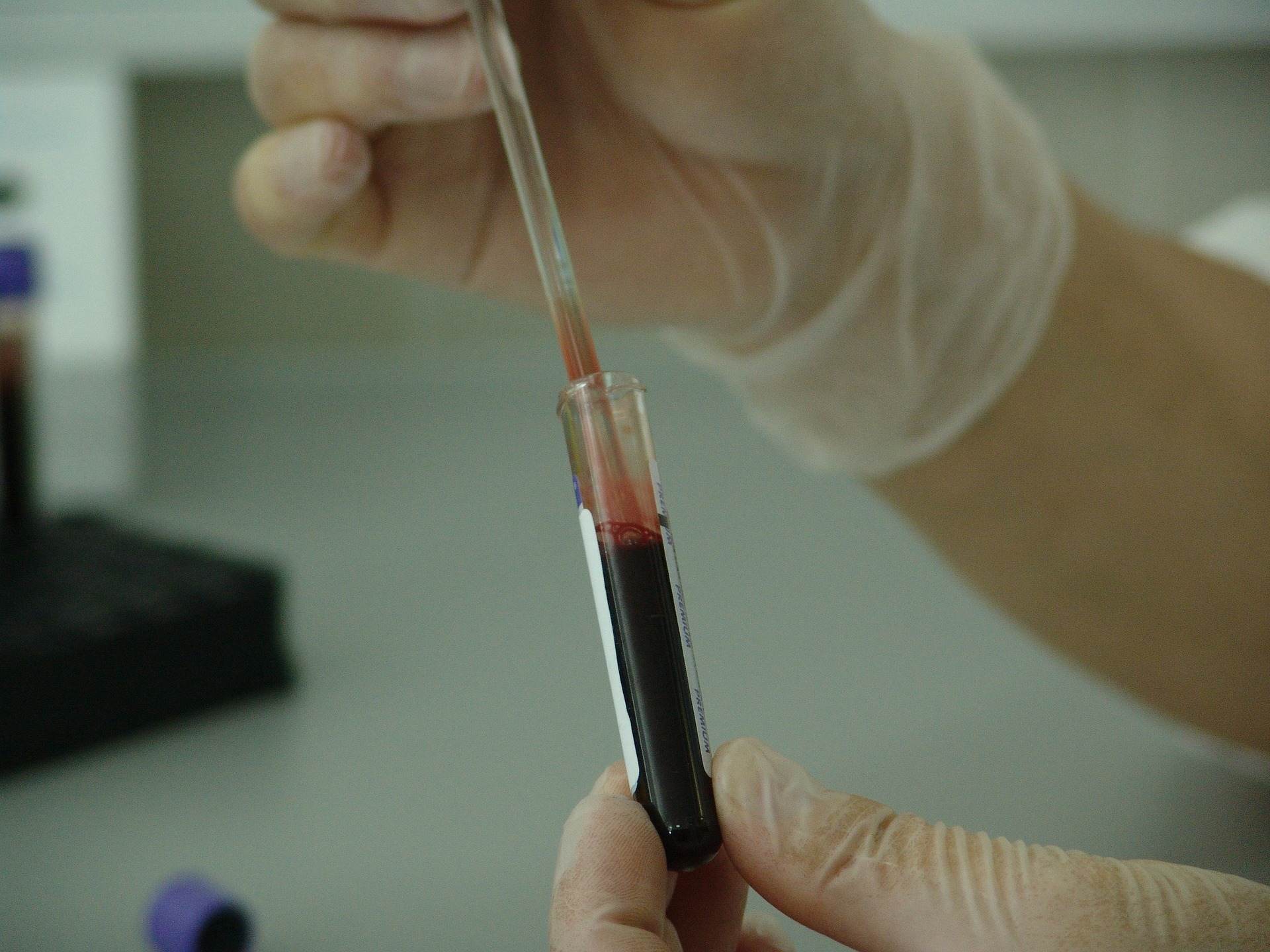 Ein Teststäbchen mit Ampulle im Labor